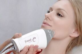 la esencia del procedimiento fraccional de rejuvenecimiento de la piel del rostro